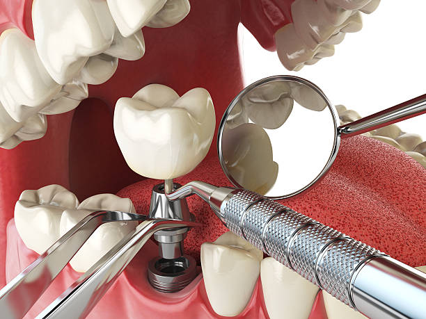 Best Emergency Tooth Extraction in Greendale, IN